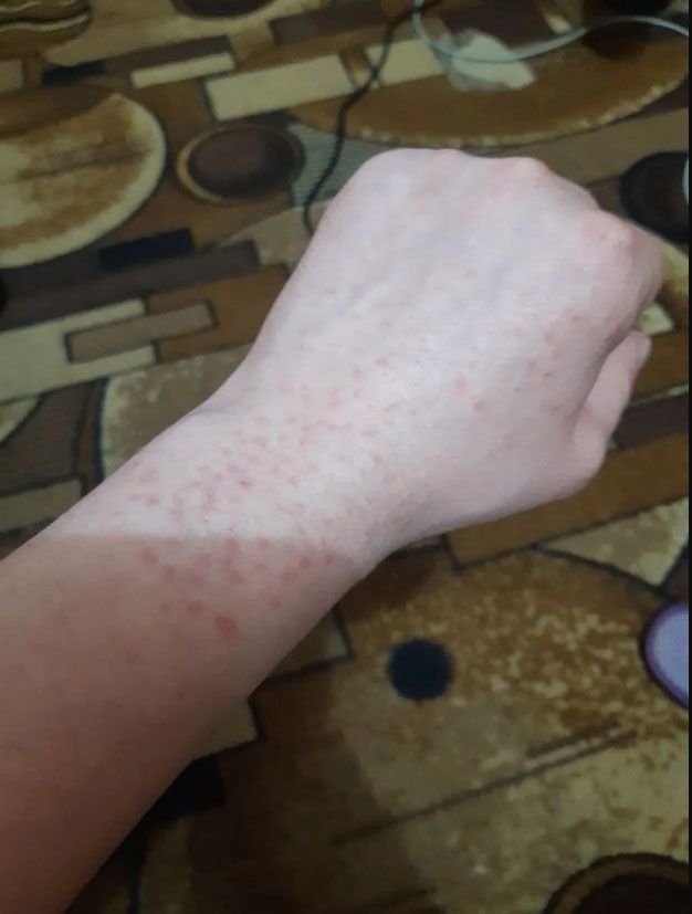 vod2